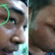 Kondisi Azif Saat Usai Dipukul Oleh Oknum Aparat Kepolisian Di Pamekasan.