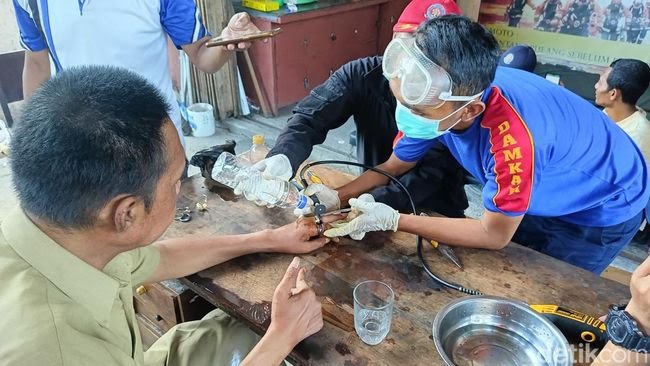 Perjuangan Petugas Saat Melepaskan Cincin Dari Jari Ramli. (Dok. Detik)